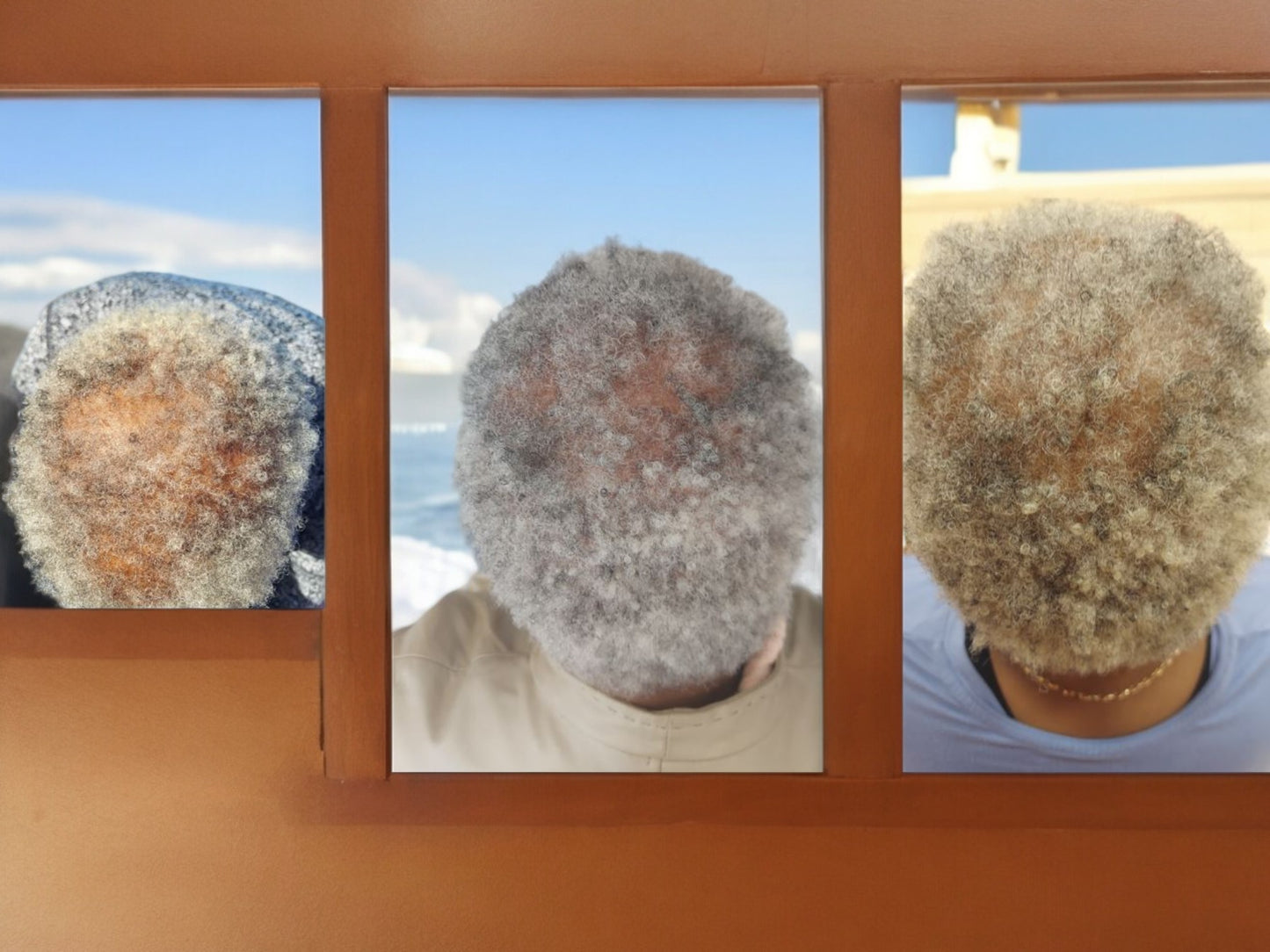 Hair Restoration Scalp Soothing Kit